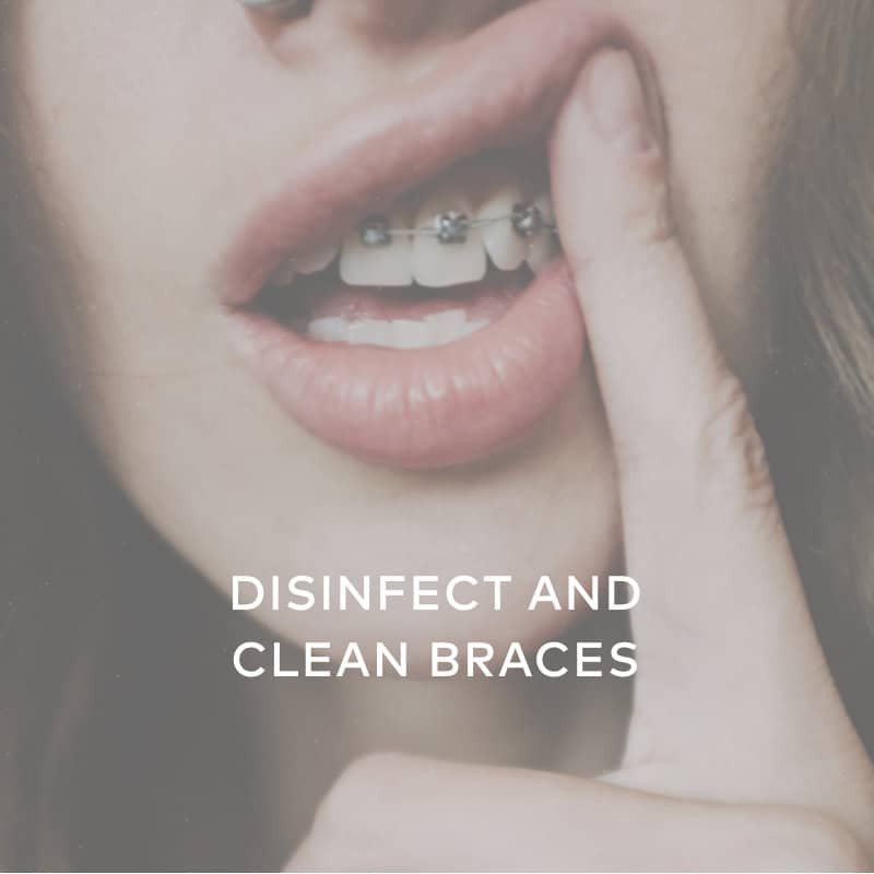 How to Clean Retainers? Braces, Invisalign, Aligners